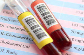 Under 45? Lowering Your Cholesterol Now Could Prevent Heart Disease Later, Study Suggests