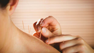 4 Ways Acupuncture Helps Restore Balance to the Body