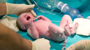 Umbilical Cord Blood Tests Reveal Widespread PFAS Contamination